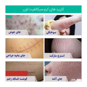 ژل ترمیم کننده فوری Cicalfate اون