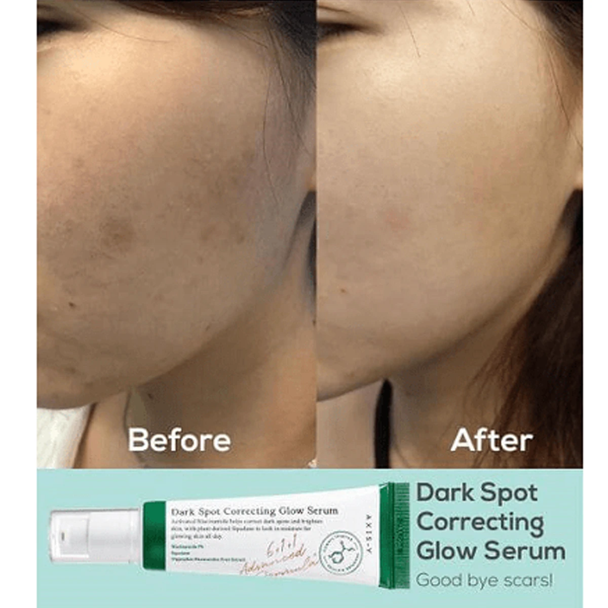 سرم روشن کننده و ضد لک اکسیس وای حجم 50 میلی